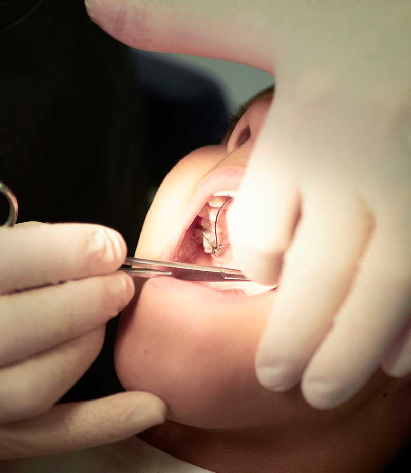 odontopediatria-5-alteraciones desarrollo dientes
