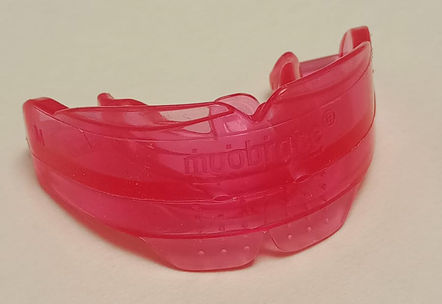 Tratamiento del bruxismo en Valladolid con férula de descarga